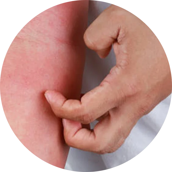 Close-up image of a person scratching the anal region, representing persistent itching caused by piles.